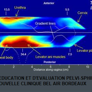 Pascal BLONDELLE Bordeaux, , Périnéologie Pédiatrique